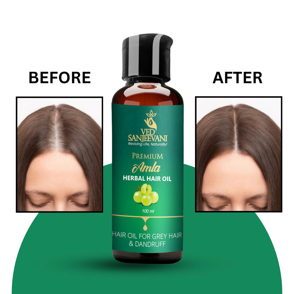 Amla Herbal Hair Oil – Ayurvedic hair oil for strong roots, hair growth, and deep nourishment