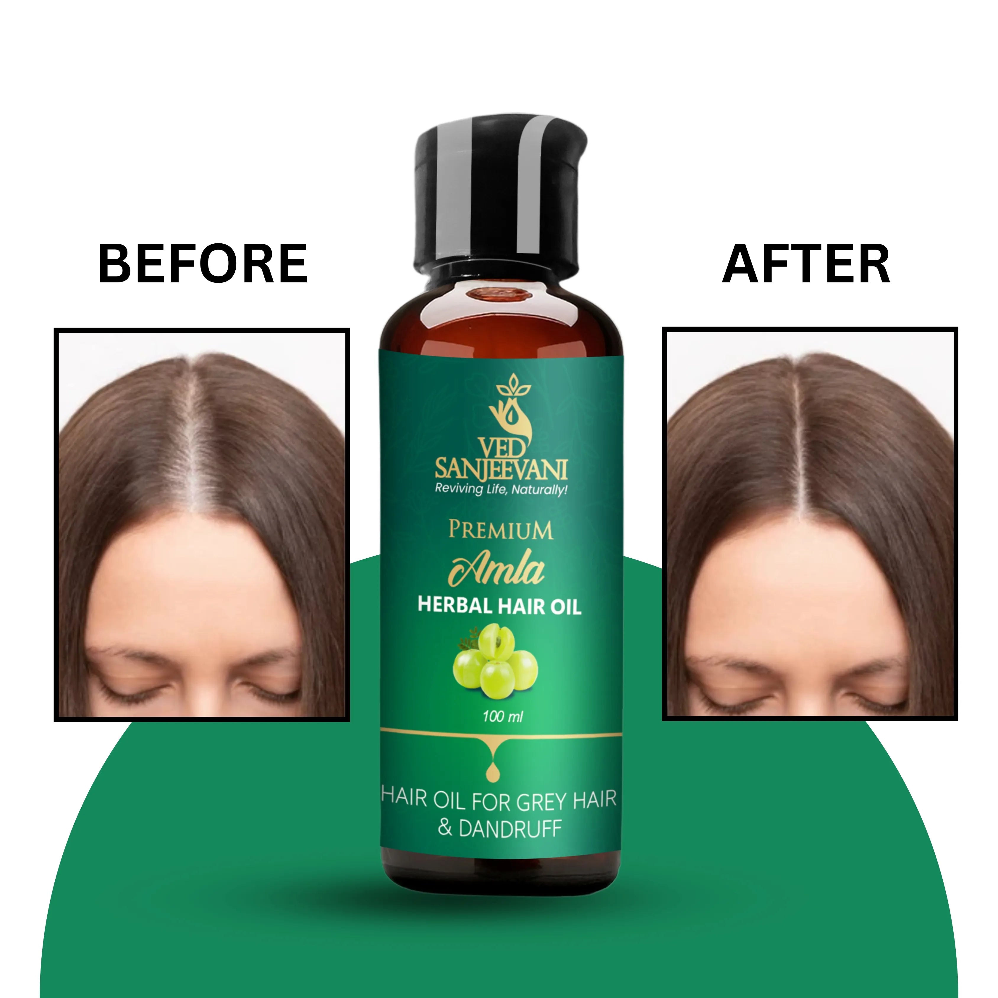 Amla Herbal Hair Oil – Ayurvedic hair oil for strong roots, hair growth, and deep nourishment
