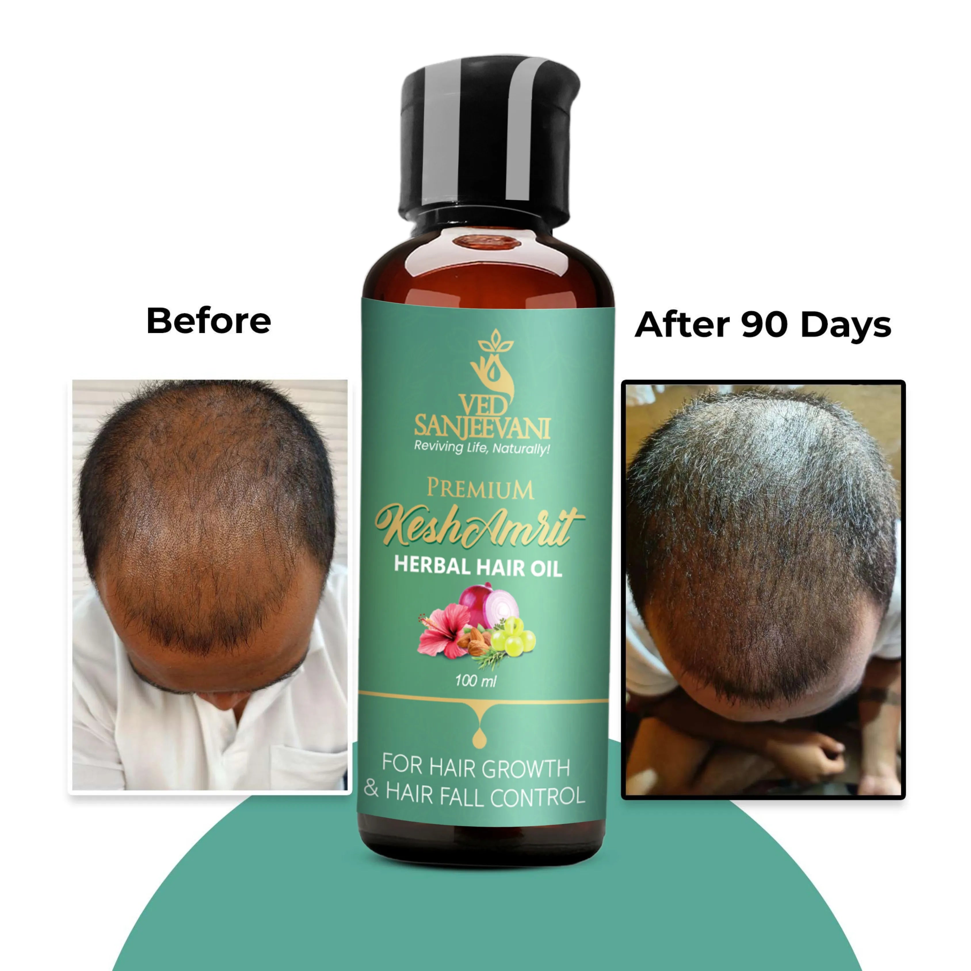 Kesh Amrit Herbal Hair Oil – Ayurvedic hair oil for stronger roots, hair growth, and deep nourishment