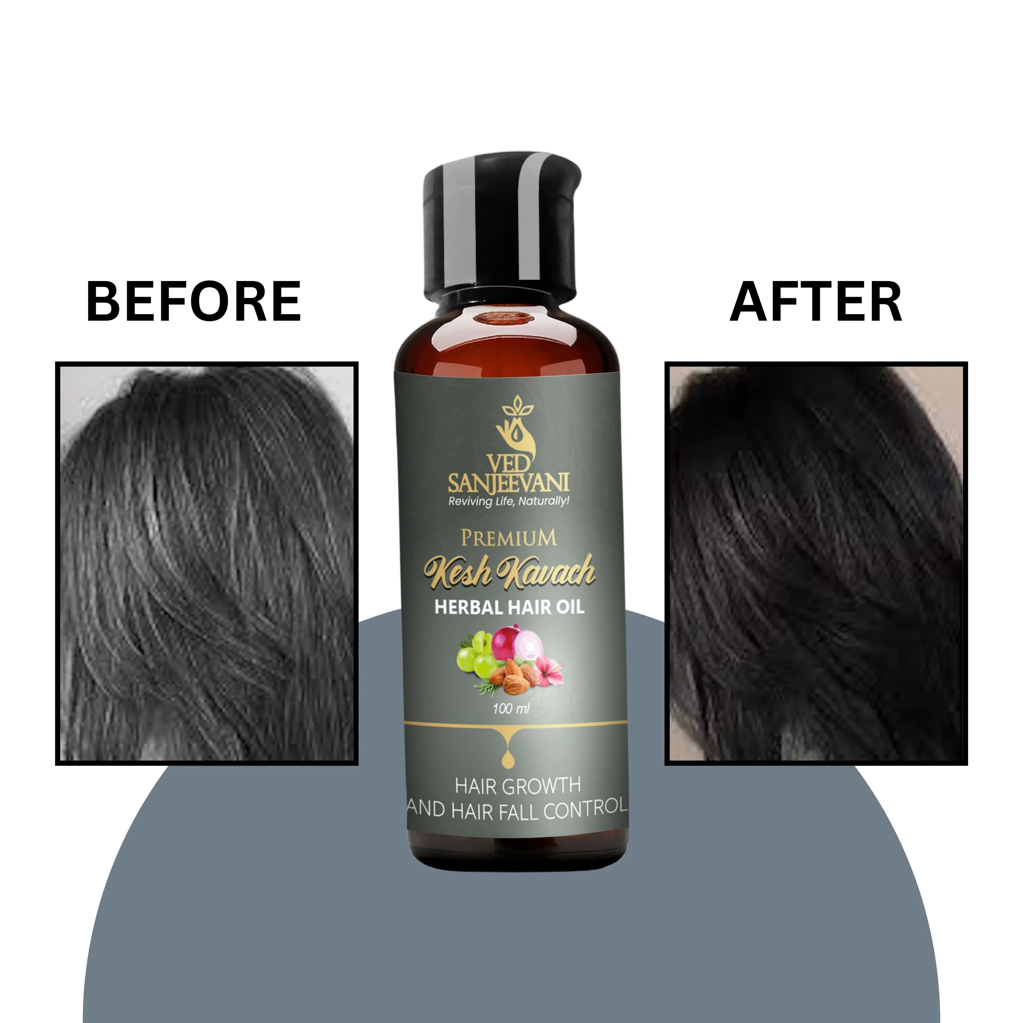 Kesh Kavach Herbal Hair Oil – Ayurvedic hair oil for hair strengthening, growth, and scalp nourishment